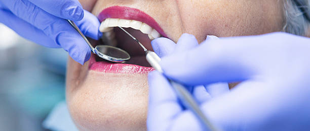 Best Emergency Wisdom Teeth Removal in Colmar Manor, MD