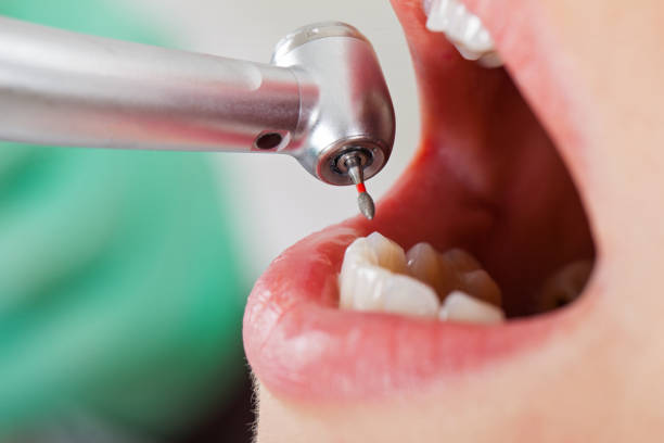 Best Weekend Emergency Dentist in Colmar Manor, MD